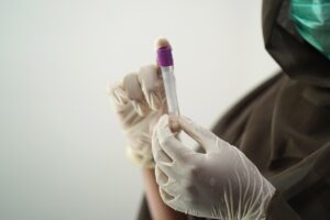 医療脱毛は学生にとってどのくらいの期間で効果が出るか？